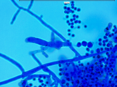 <p>“grape-like” clusters microconidia</p>