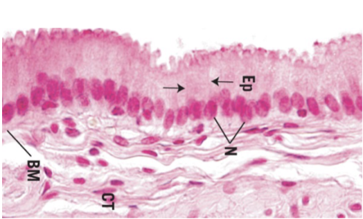 <p>identify tissue type and what it shows.</p>