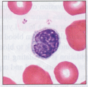 <p>Cells are classified as small (5-8 um), medium (10-12 um), or large (14-17 um); characterized by a realtively large, round, dark-staining nucleus surrounded by a narrow rim of cytoplasm</p>