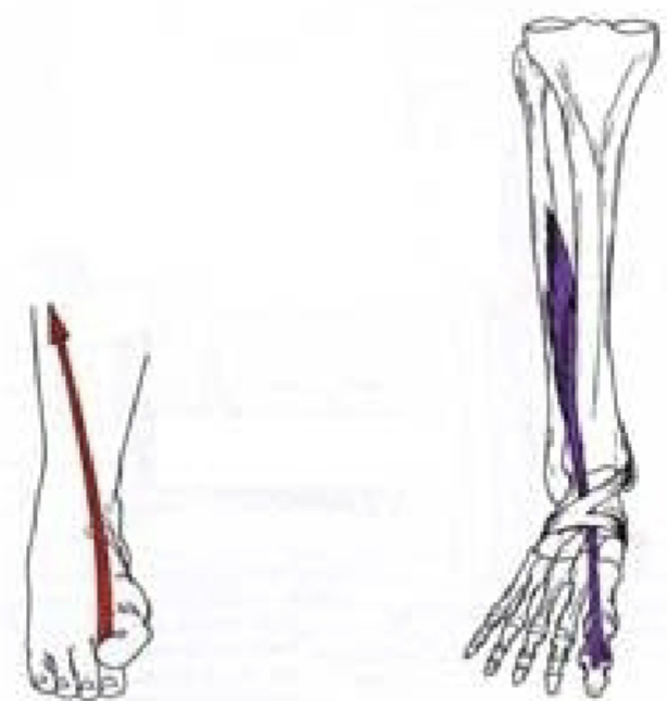 <p>Origin: Middle part of the anterior surface of the fibula and interosseous membrane</p><p>Insertion: Distal phalanx of the great toe</p><p>Action:</p><ul><li><p>Extends the great toe</p></li><li><p>Dorsiflexes the ankle</p></li></ul><p>Innervation: Deep Fibular Nerve</p>