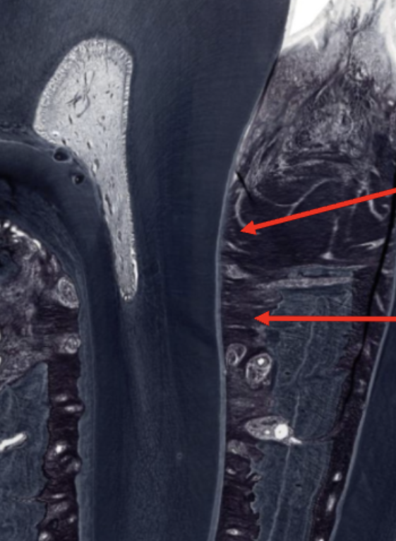 <p>ID the fibers (bottom right arrow)</p>