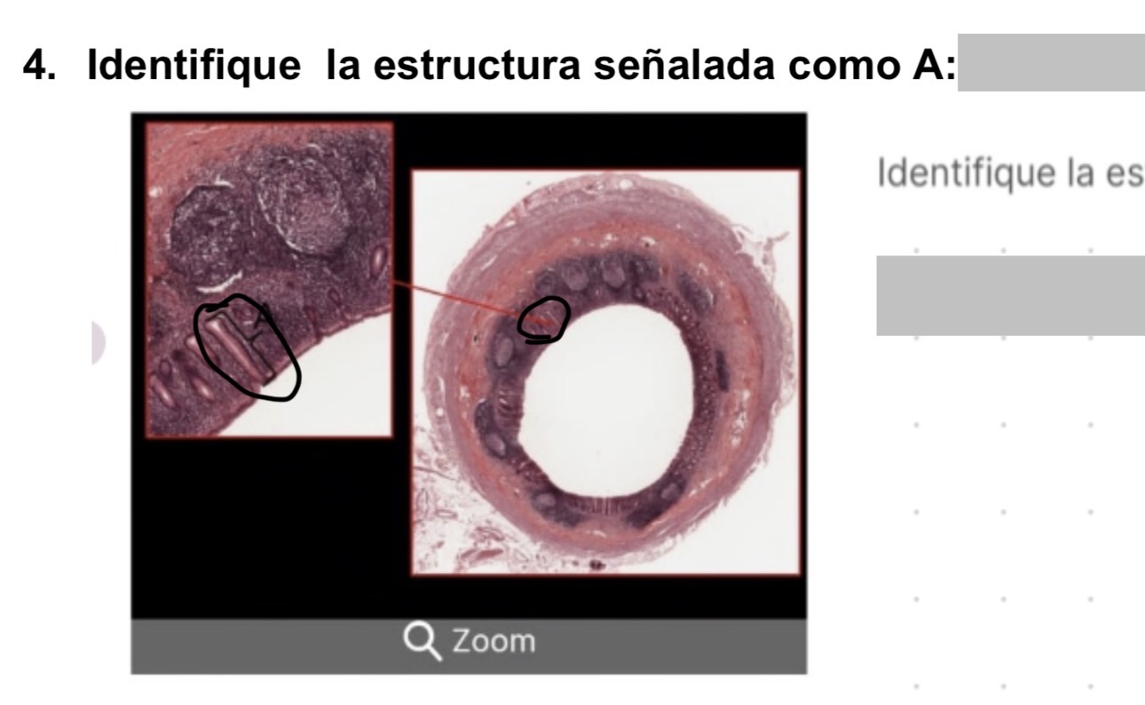 <p>criptas de lieberkuhn </p>
