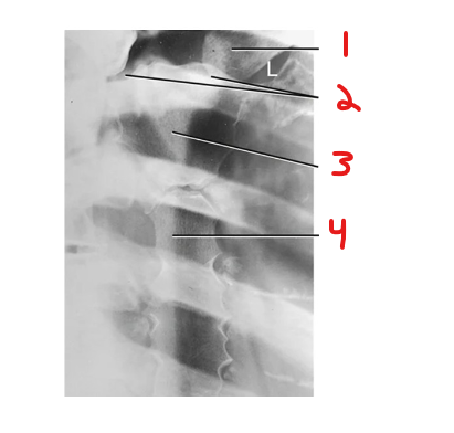 <p>Label</p>