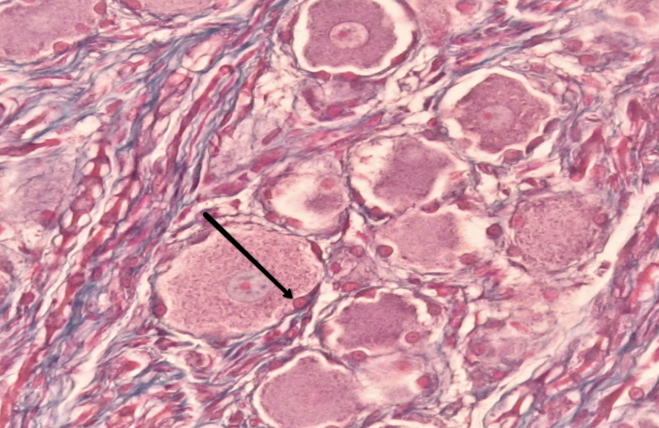 <p><span><strong>Identify the small red structure at the tip of the pointer.</strong></span></p>