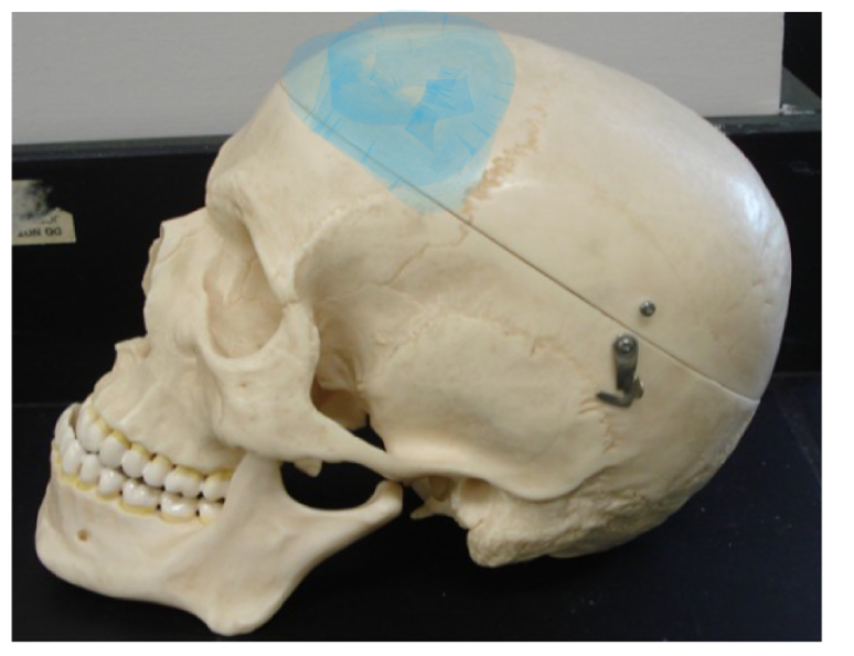 <p>What is this part of the skull; lateral </p>