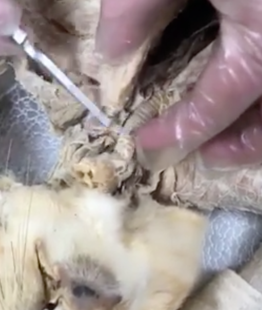 <p>what is the “bendy straw” structure prong is pointing to</p>