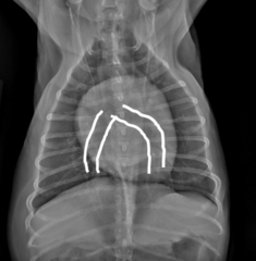 <p>Left bronchus deviation (bow legged cowboy)</p>