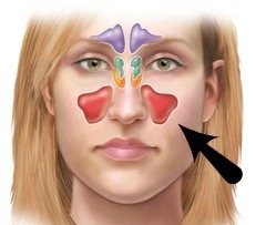 <p>collectively are the largest sinus that can cause some pain; drains into ostium</p>
