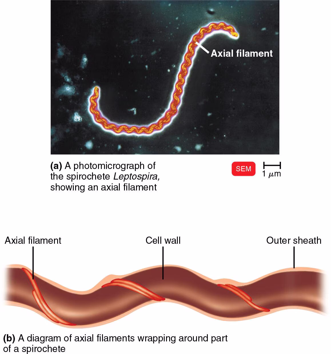 <ul><li><p>bundles of fibrils that arise at the ends of the cell beneath an outer sheath and spiral around the cell</p></li><li><p>in spirochetes</p></li><li><p>called “endoflagella”</p></li><li><p>anchored at one end of the cell</p></li><li><p>rotation causes the cell to move</p></li></ul><p></p>