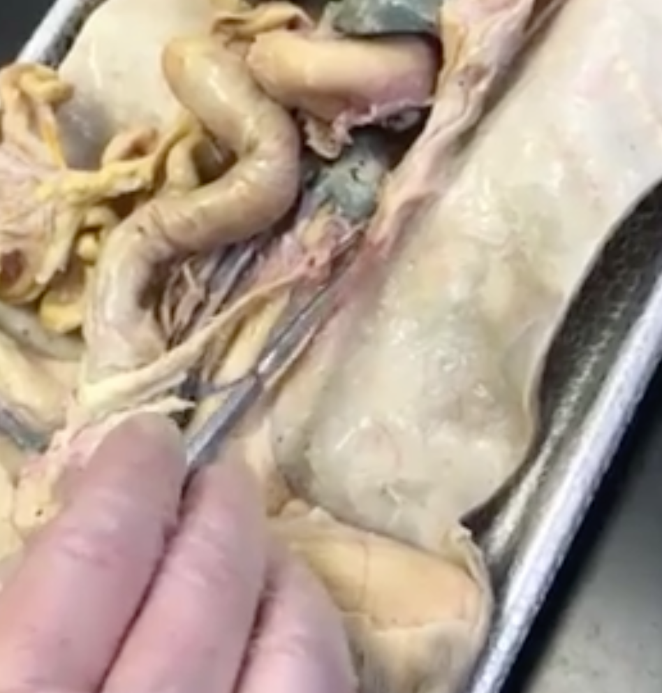 <p>what is the “white string” structure the prong is touching</p>