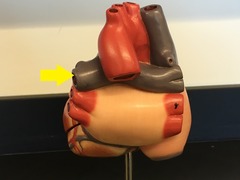 <p>Identify the vessel (be specific)</p>
