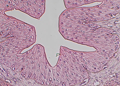 <p><br><strong>[Identify this type of epithelium.]</strong></p>