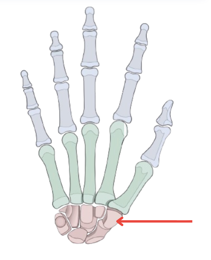 term image