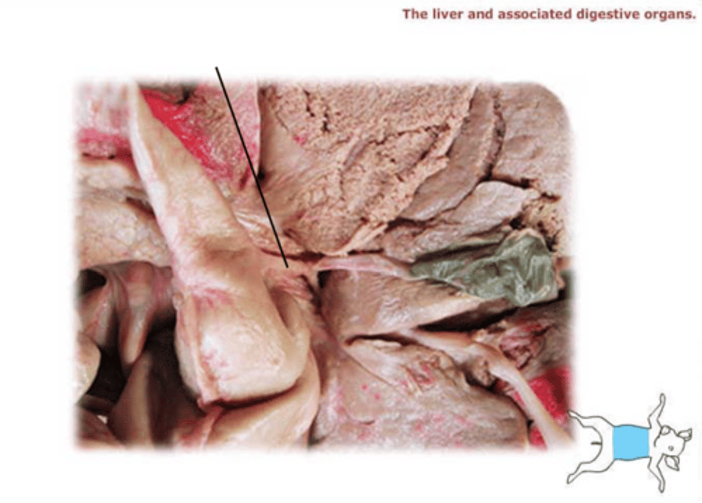 <p>A tube that carries bile from the liver and gallbladder to the intestine</p>