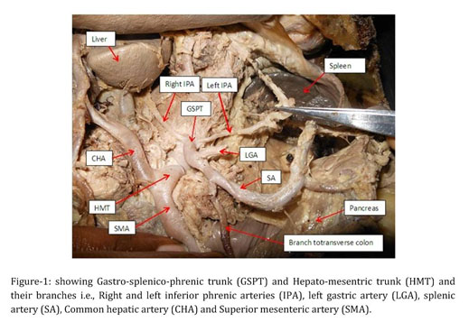 <p>behind stomach along upper boarder of pancreas</p><p>TA will flip stomach up and it is the second branch off of the celiac trunk, she is thick wide and flat for an artery</p><ul><li><p>structure</p></li></ul><p></p>