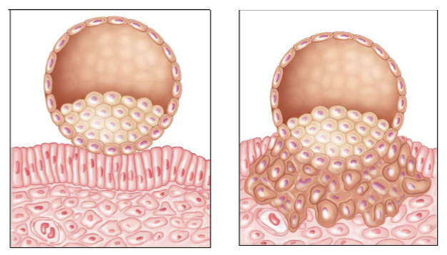 <p>The <strong>blastocyst</strong> attaches to the <strong>endometrium 6-8</strong> days <strong>post</strong> <strong>fertilization</strong></p>