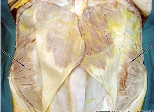 <p>what muscle is being indicated to in the image</p>