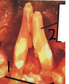 <p>What gender is this crayfish </p>