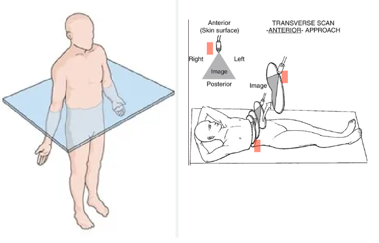 <p>Divides body into superior and inferior</p><p>Transducer indicator notch towards US machine</p>