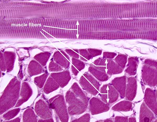 <p>striated, nucleus is off to the side, white endomysium </p>