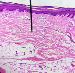 <p>What kind of tissue is this?</p>