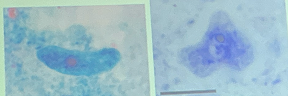 <ol><li><p>Iodamoeba buetschlii</p></li><li><p>Trophozoite</p></li></ol><p></p>