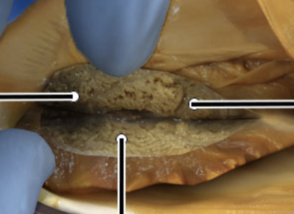 <p>What structure is the bottom arrow pointing to?</p>