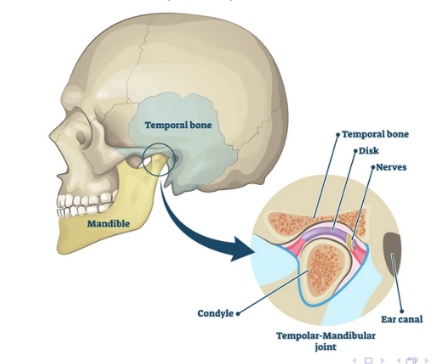 <p>connects the <em>mandible</em> to the <em>temporal bone</em> of skull </p><p>consist of the <em>condyle of the mandible</em> and the<em> mandibular fossa</em> of the temporal bone </p><p>cushioned by a<em> fibrous articulator disk</em> for smooth movement </p>