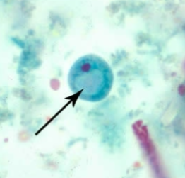 <p>Prominent vacuole</p><p>8-20 microns</p>