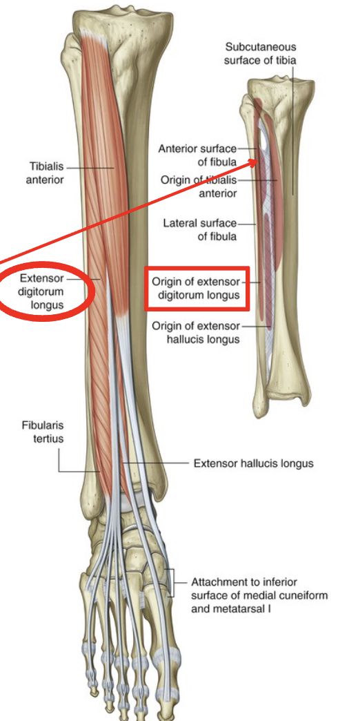 <p>O: lateral tibial condyle, interosseous membrane, proximal 2/3 anterior fibula</p><p>I: base of middle and distal phalanges of lateral 4 toes via dorsal digital expansions</p><p>A: extension of MTP, PIP, DIP joints of lateral 4 toes, DF and eversion of foot</p>