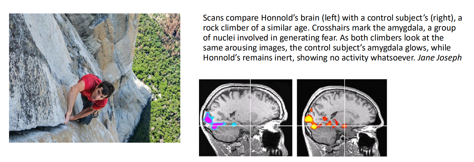<ul><li><p>comparison condition?</p></li><li><p>Guess what brain regions would be commonly activated across both conditions, and what would be uniquely activated in the experimental condition.</p></li></ul><p></p>