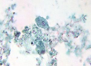 single nucleus, small karysome, granular ring of chromatin