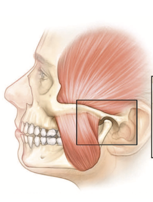<p>What keeps the temporomandibular joint stable?</p>