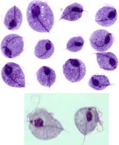 <ul><li><p>protozoan</p></li><li><p>causes trichomoniasis</p></li></ul><p></p>