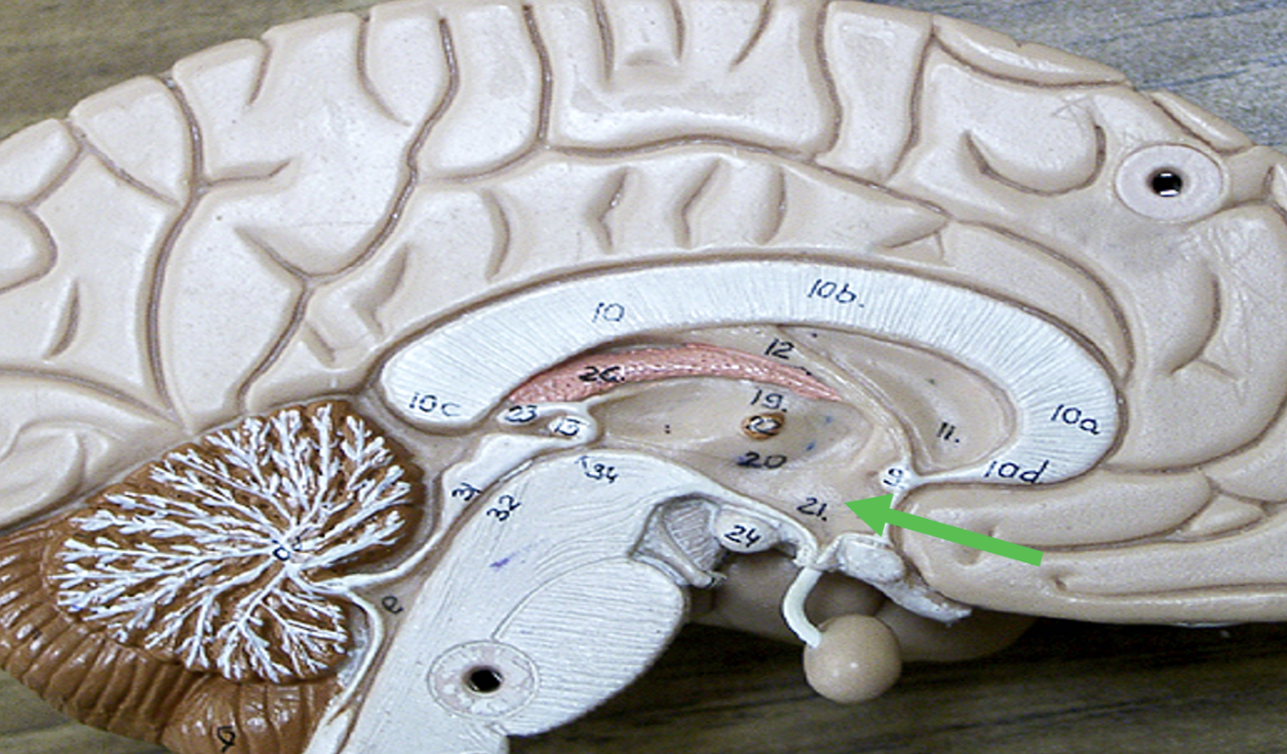 <p>Identify the area of the brain indicated by the pointer.</p>