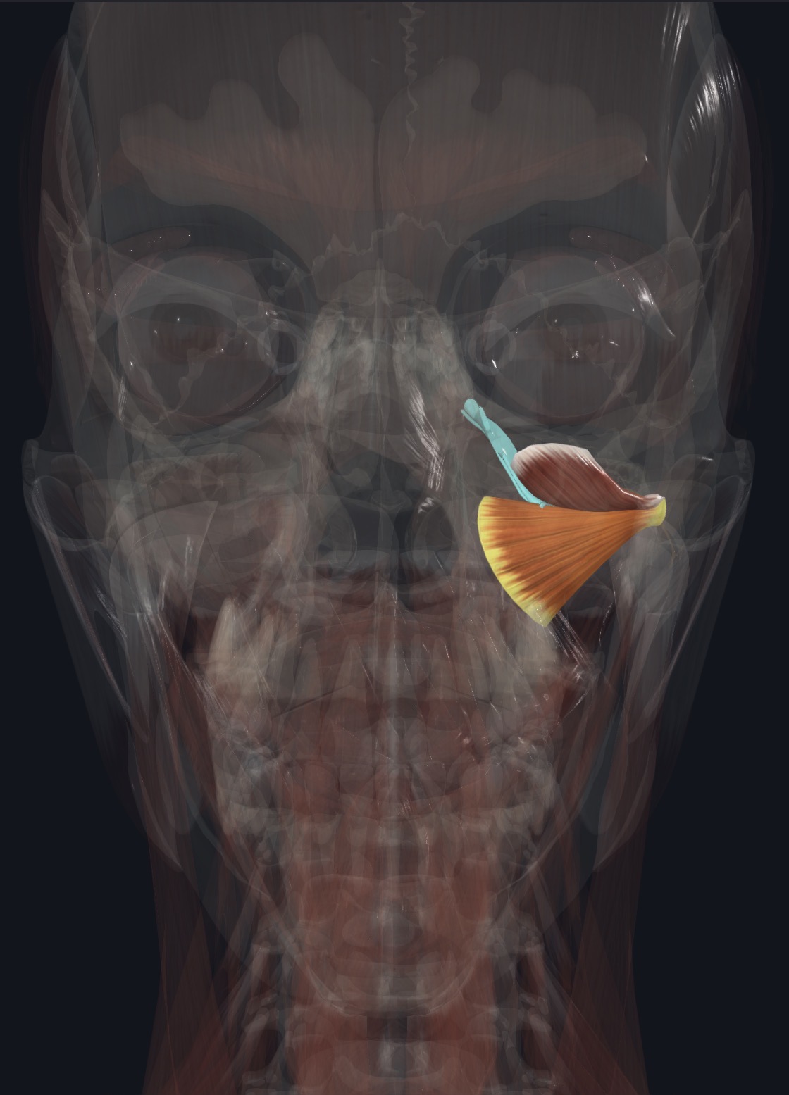<p>Ant. Trunk of mandibular N (CN V3) via lateral pterygoid N.</p>