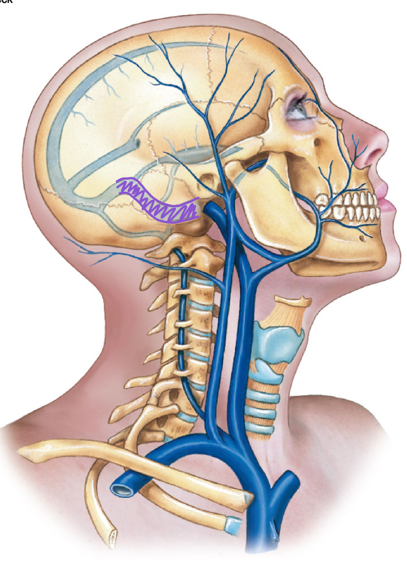<p>diagram </p>