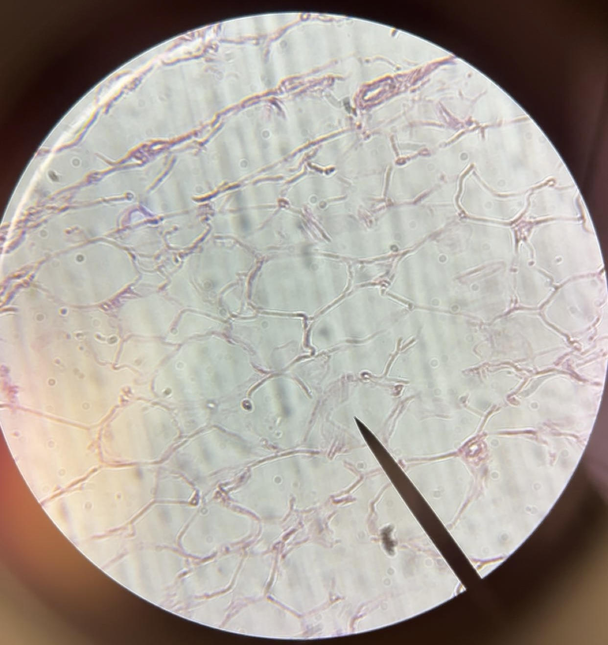 <p>tissue</p>