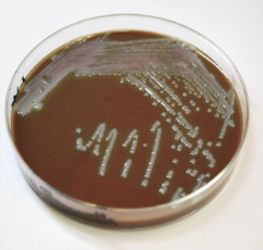 <p>to grow fastidious microorganisms (like Neisseria and Haemophilus bacteria) that need extra nutrients (X and V factors) and require a low oxygen and high CO2 environment to grow.</p>