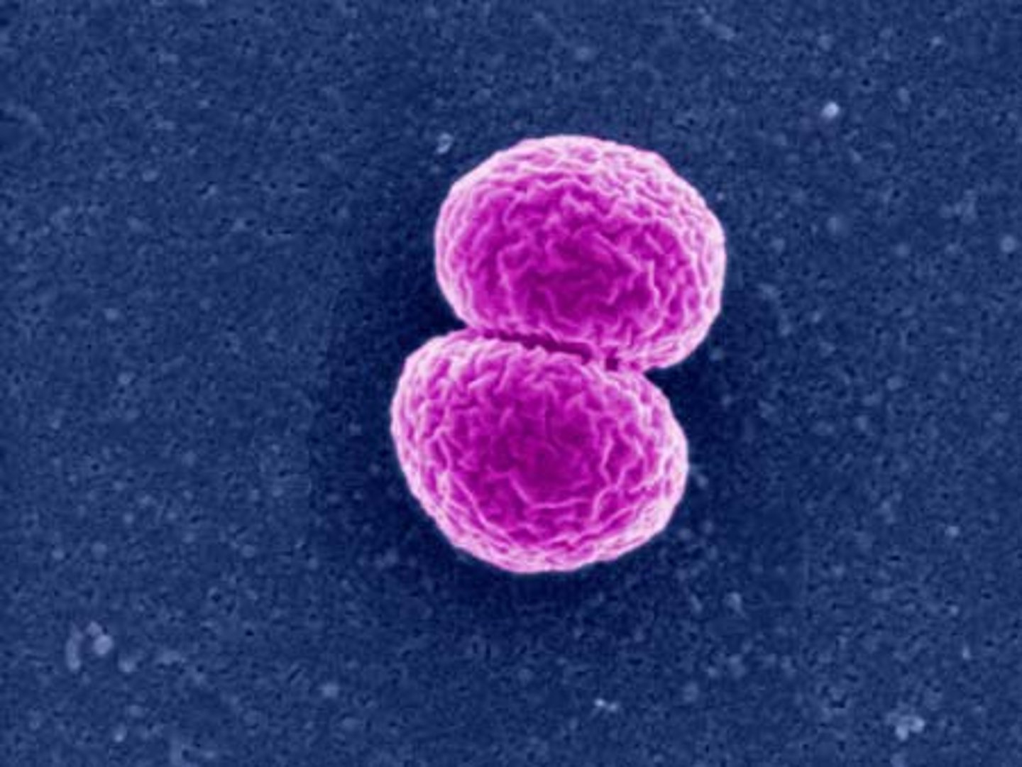<p>Spherical bacteria that grow in pairs</p>