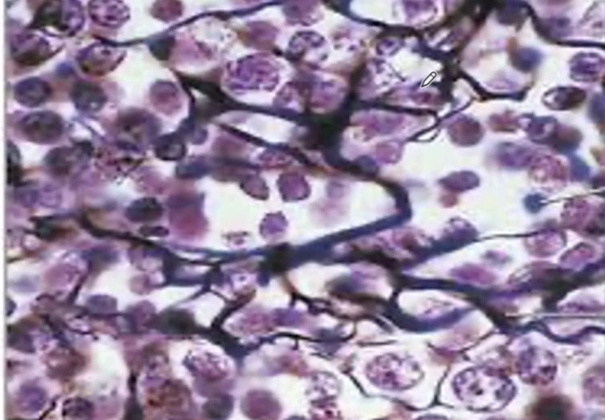 <p>What tissue is this? </p>