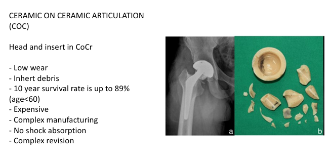 <p>Head and insert in CoCr</p><ul><li><p>Low wear- Inhert debris</p></li><li><p>10 year survival rate is up to 89% (age<60)</p></li><li><p>Expensive- Complex manufacturing</p></li><li><p>No shock absorption</p></li><li><p>Complex revision</p></li></ul><p></p>