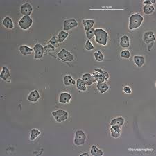 <p>Squamous Epithelial Cells</p>