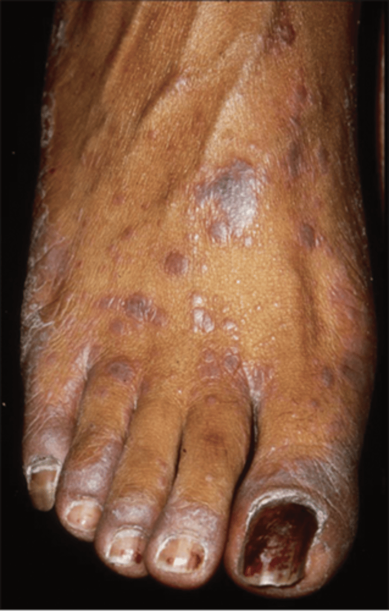 <p>hepatitis panel</p><p>biopsy to confirm dx</p>