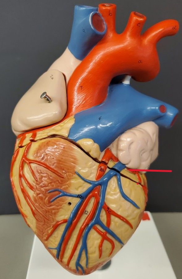 <p>Name the artery</p>
