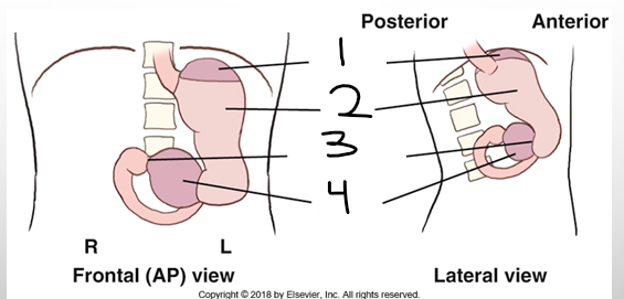<p>what is 2?</p>