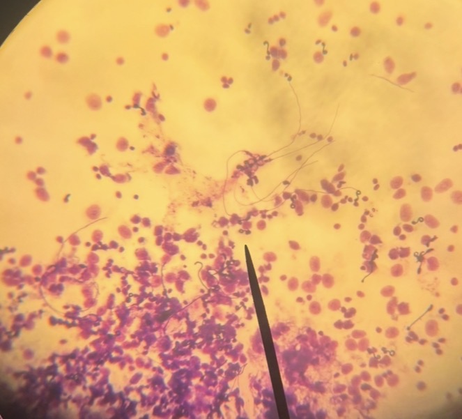 <p>What phylum is this? What are these called?</p>