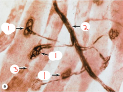 <p>What is labeled 3?</p>