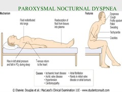<p>paroxysmal nocturnal dyspnea</p>