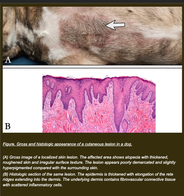 <p>A dog has worn a poorly fitted harness during daily exercise for several weeks. The skin over the sternum becomes thickened. Histologic examination shows:</p><p>- Increased number of epithelial cell layers (thickness 2-3x normal)</p><p>- Epithelial cell size: unchanged</p><p>- Cell type: remains stratified squamous epithelium throughout</p><p>- Basement membrane: intact</p><p>- No membrane rupture or inflammatory infiltration within the epithelium</p><p></p><p><strong>Which interpretation best explains the observed skin changes?</strong></p><p>a. Mechanical stress enlarges epithelial cells, producing thickening through hypertrophy</p><p>b. Mechanical irritation stimulates increased epithelial proliferation, producing thickening through hyperplasia</p><p>c. Mechanical stress decreases oxygen delivery, producing epithelial swelling from reversible injury</p><p>d. Mechanical irritation replaces squamous epithelium with another cell type through metaplasia</p>